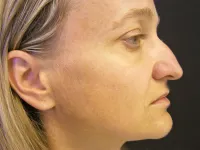 Foto: archiv kliniky ESthÉ