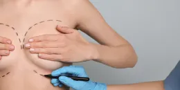 Foto: archiv kliniky Esthé a Jaroslav Fikota