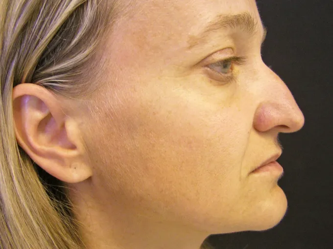 Foto: archiv kliniky ESthÉ